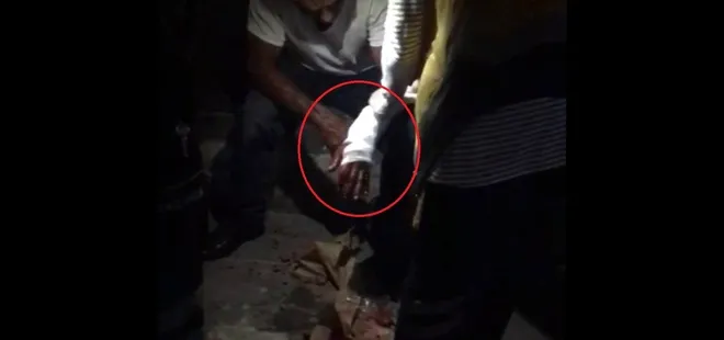 Uyardığı kadın tarafından bıçaklandı