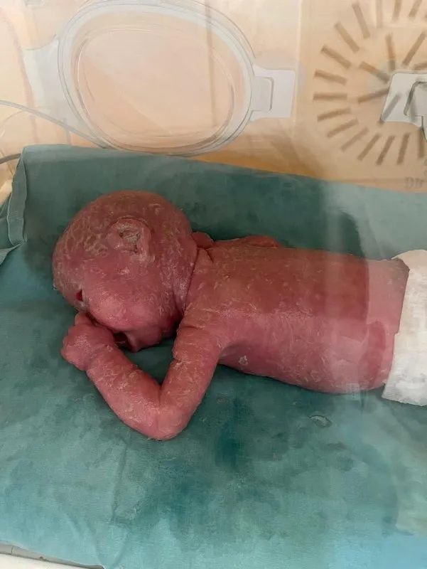Yılan bebek Gökdeniz Tuncer 1 yaşına girdi! Annesi sadece bir kez öpebildi