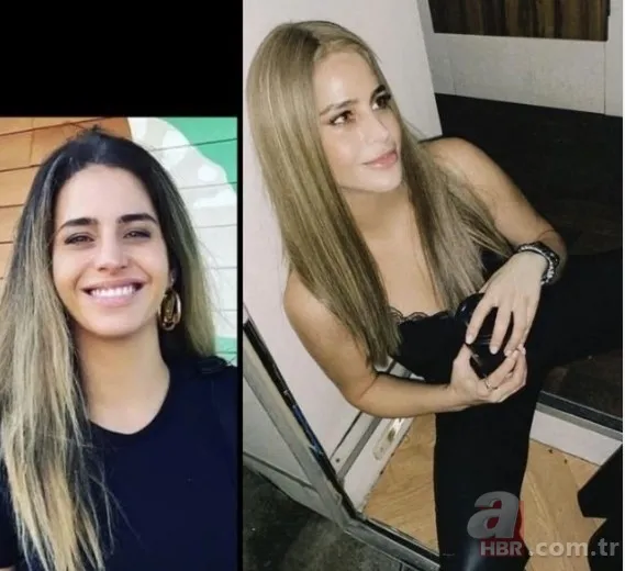 Büşra Pekin’de estetikle yeni birine dönüşenler kervanında! 1 estetiğim var deyince ti’ye alınmıştı… 4 bantla o hale gelmiş! 14