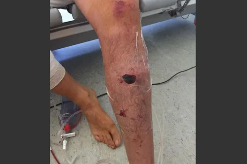 Almanya'da Türk çifte ırkçı saldırı - 1