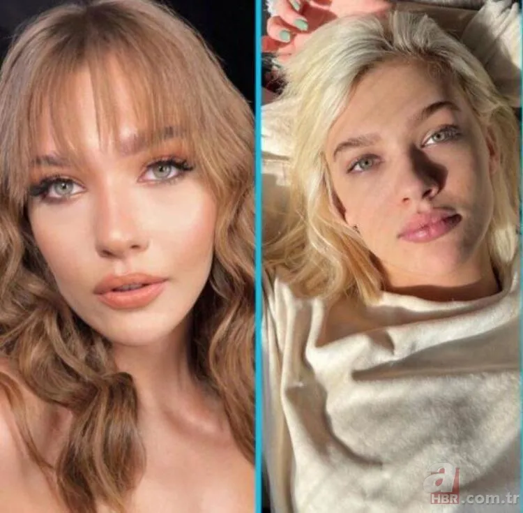 Hayal Köseoğlu'nu gören tanıyamadı! Estetiksiz hali şoke etti 5