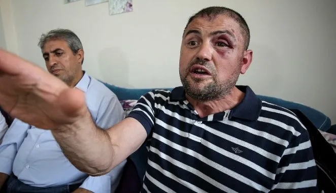 Bursa'da gaziyi döven 3 kişi tutuklandı, kafenin işletmecisi hakkında hukuki süreç başlatıldı - 1