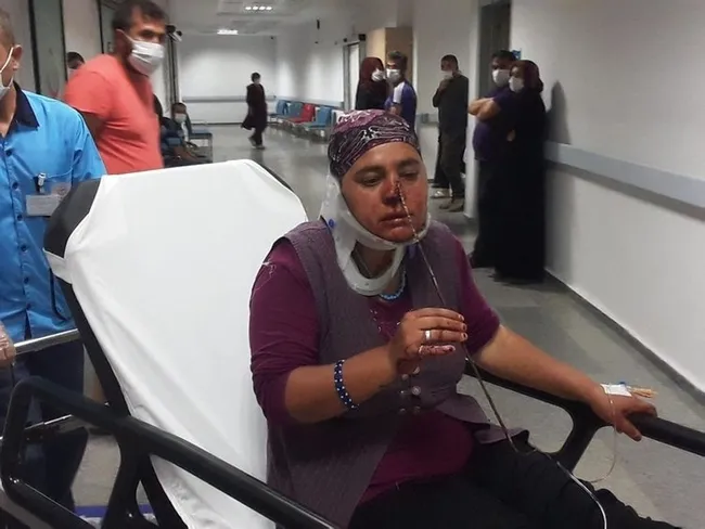 Aksaray'da kadının burnuna şiş saplandı - 1