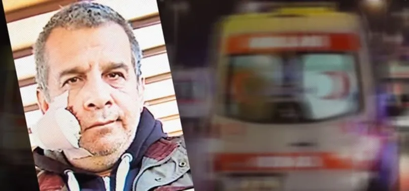 İstabul'da tuhaf ısırık vakası