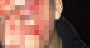 Görüntüleri çeken öğrenci saldırıya uğradı