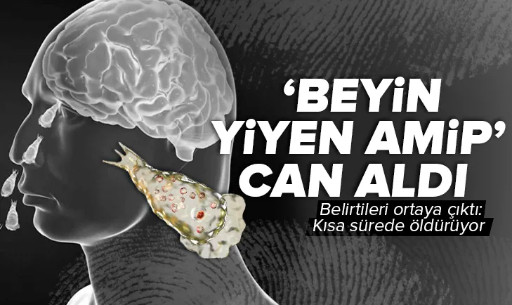 ’Beyin yiyen amip’ can aldı! Belirtileri ortaya çıktı