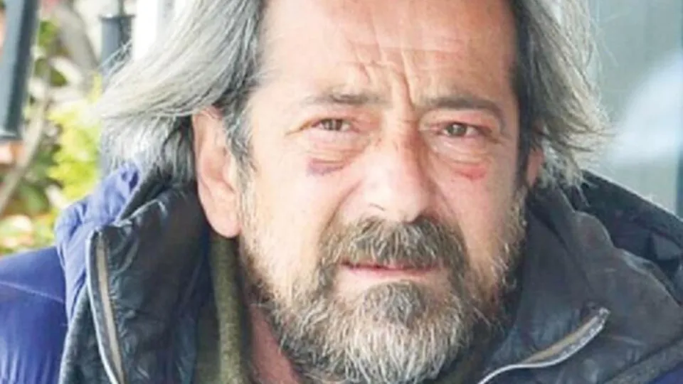 Feridun Düzağaç'ın son hali korkuttu