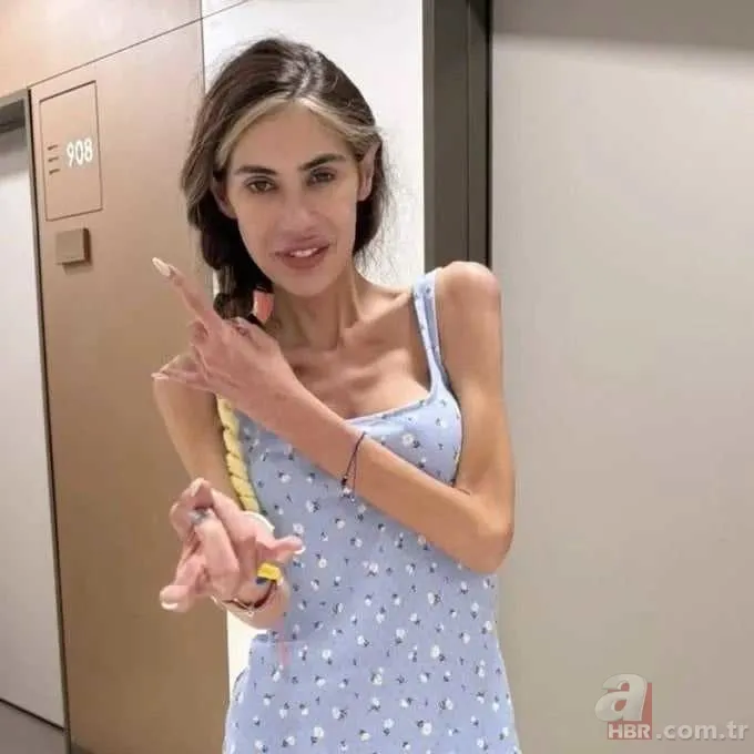 Anoreksiyadan hayatını kaybeden Nihal Candan'ın acılı babası konuştu: Şöhret dünyasına girince sapıttı 5