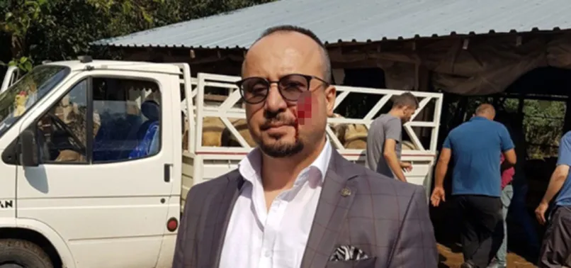 Bursa'da koyunları hacze giden avukat yanağından ısırıldı