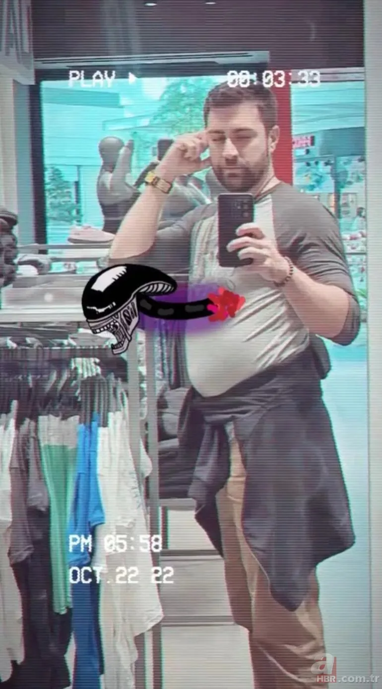 Çağlar Ertuğrul’un aldığı kilolar şoke etti! Tanınmaz hale geldi 8