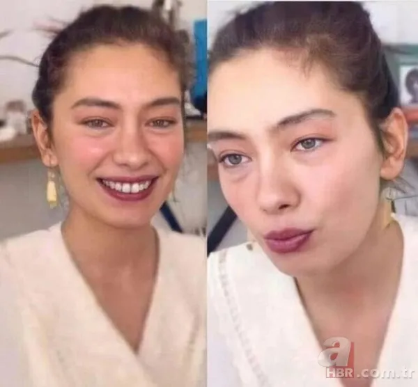 Uraz Kaygılaroğlu açıkladı! Neslihan Atagül'ün sağlık durumu… 7