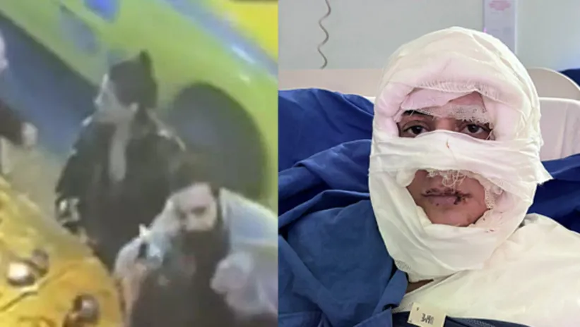 Kadıköy’deki dehşette yeni detaylar! Yakılan kadına korkunç mesaj: Kız arkadaşım sizin yüzünüzden hapse girdi