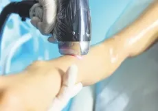 Lazer epilasyon dehşeti! Kabusu yaşadı