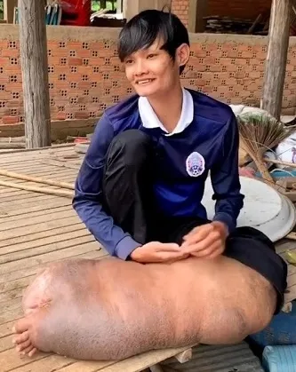 Sivrisinek ısırığı tedavisi olmayan hastalığa sebep oldu