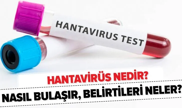 Son dakika: Hantavirüs Türkiye’de var mı? Hanta virüsü nasıl bulaşır, belirtileri nelerdir?