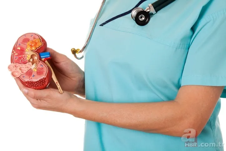 Böbrekleri tüketen 10 neden (Diyalize mahkum olmamak için dikkat) 1