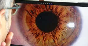 İris fotoğrafçılığı ilgi görüyor