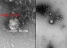 Son dakika: Dünyayı heyecanlandıran kare! İşte mutasyonlu koronavirüsün ilk fotoğrafı | Rus bilim insanları duyurdu
