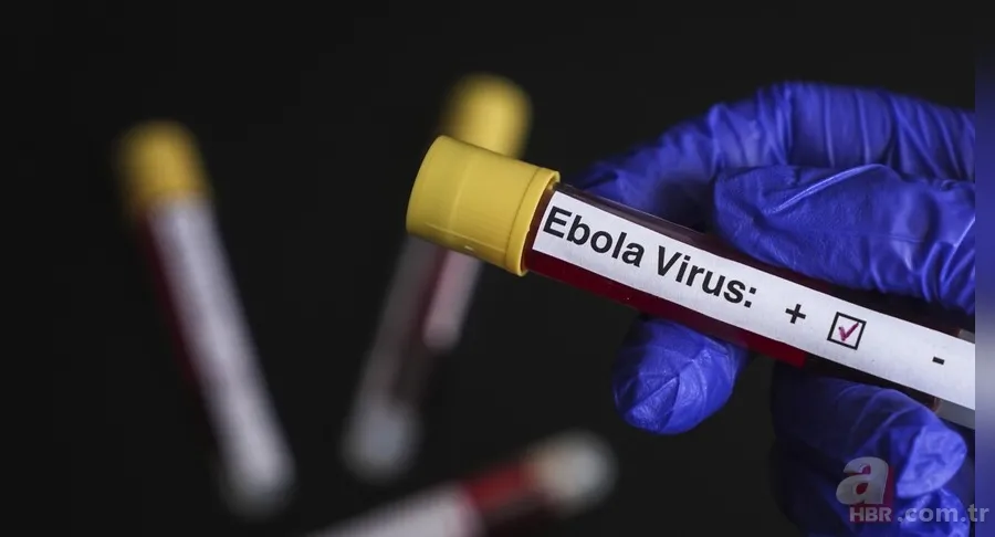 Ebola salgını hızla yayılıyor! Batı ülkeleri yardım bütçelerini kesti, küresel risk kapıda 7
