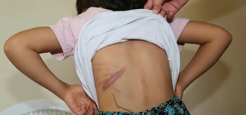 Şanlıurfa'da cani baba dehşeti: Eşi ile 4 çocuğunu kemer ve sopayla dövdü