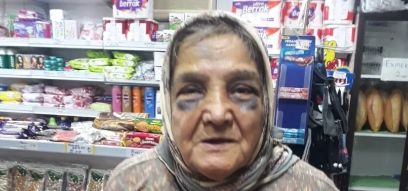 Cani koca dehşet saçtı! 73 yaşındaki eşini döve döve bakın ne hale soktu