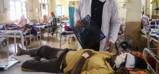 Hindistan’da koronavirüsten sonra ’siyah mantar’ alarmı verildi! Hastaların gözleri oyuldu
