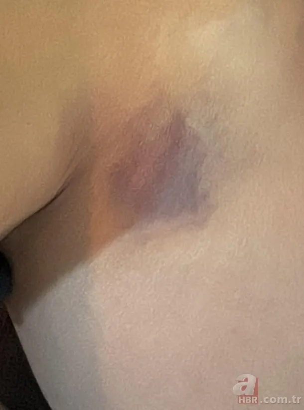 Yıldız Asyalı'nın eşinden açıklama geldi! "Kocam beni darp etti" demişti... 7