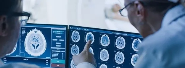 Koronavirüs ile ilgili son araştırmanın sonuçları açıklandı: Beyne girebiliyor - 5