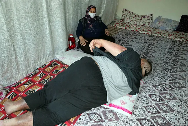 Gaziantep'te obezite hastası 280 kiloya ulaştı! Tek isteği sokakta yürümek ve çalışmak - 5