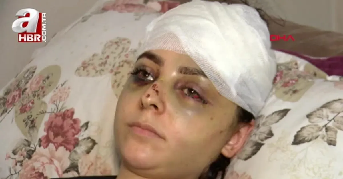 Neden tayt giydin dayağı hastanelik etti!