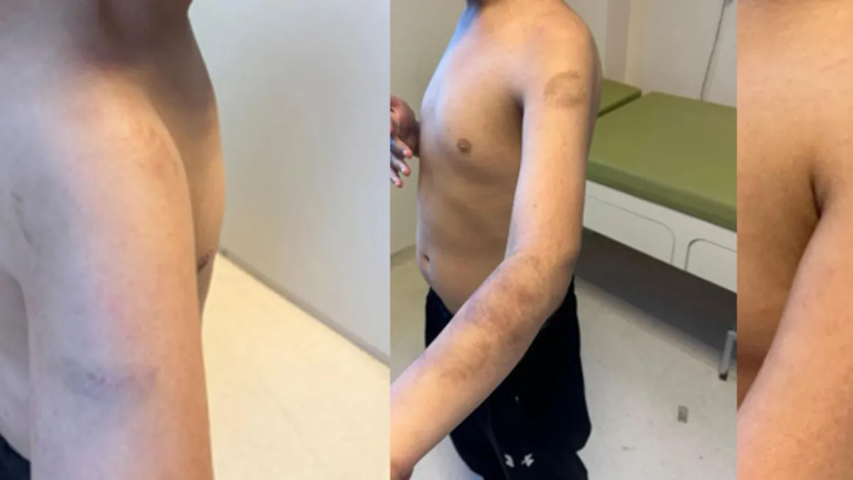 İstanbul'da özel okulda otizmli çocuğa şiddet iddiası! Skandal savunma