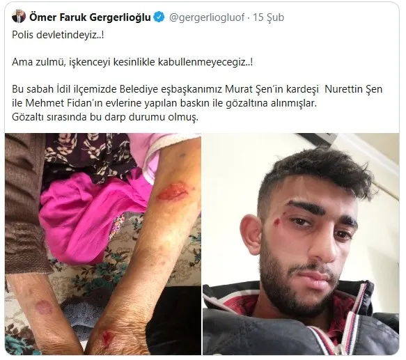 HDP Kocaeli Milletvekili Ömer Faruk Gergerlioğlu’un "polis darp etti" skandalını deşifre eden video! - 2