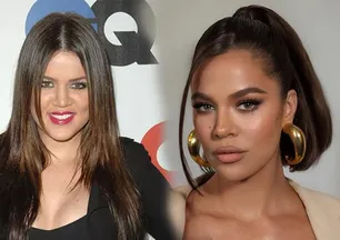 Khloe Kardashian'ın 15 yıllık estetik listesi ortaya çıktı! İşte eski ve yeni hali...