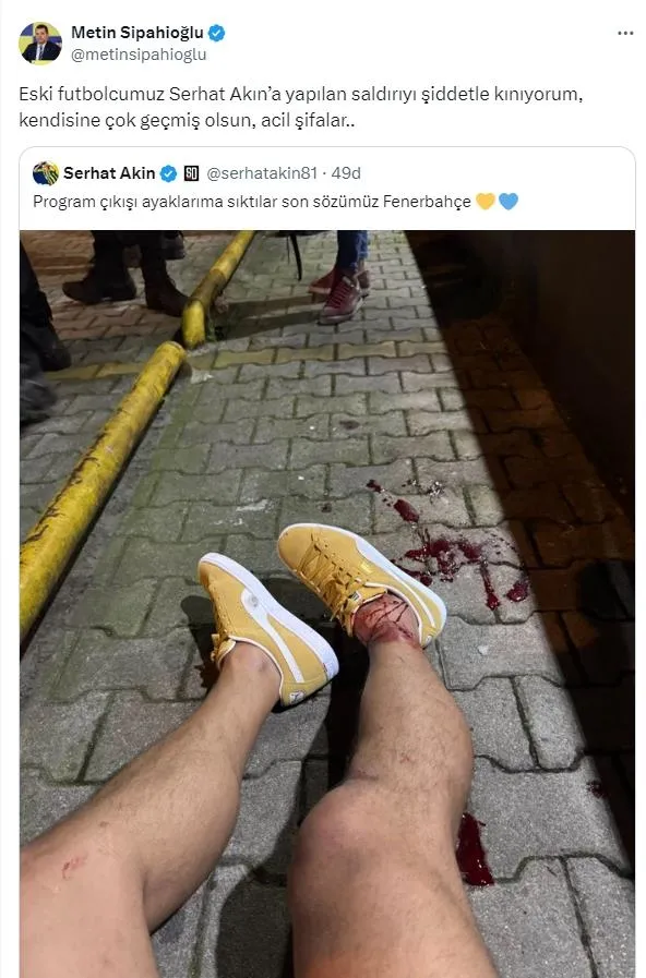 Eski Fenerbahçeli futbolcu Serhat Akın’a silahlı saldırı! İşte vurulma anı...