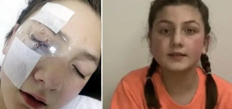 Yastık savaşı yaparken gözünden sakatlanan Belinay sağlığına kavuştu