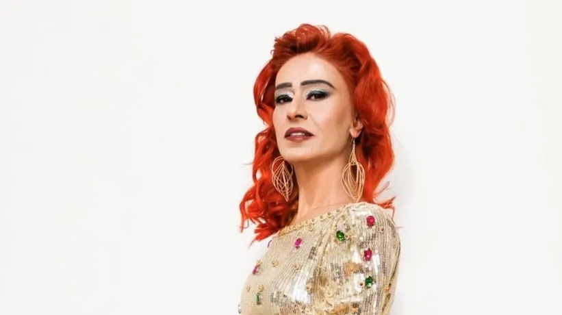Yıldız Tilbe'nin yüzü yandı! Son hali korkuttu