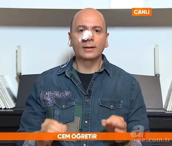 Canlı yayında burnu kanayan Cem Öğretir sağlık durumunu açıkladı! 5