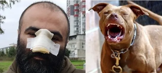 samsunda-dehset-pitbull-burnunu-kopardi-kopek-degil-sahibi-suclu-1640958780291.jpg Samsun’da dehşet! Pitbull burnunu kopardı: Köpek değil sahibi suçlu - 3