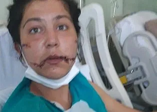 Oğlunun önüne 104 yerinden bıçaklandı: ’İlk kez bıçaklanmadım ama ilk kez doğrandım’