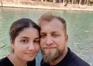 Saç ekimine girdi cenazesi çıktı!