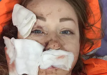 Boşanmak isteyen eşine falçatayla saldırmıştı! Cani koca tehditlerine devam ediyor