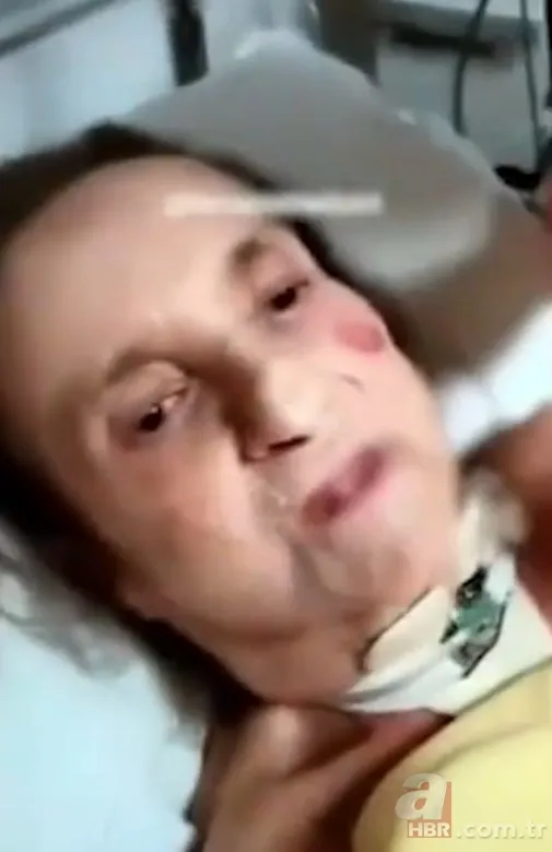 Özel hastanede skandal! Yoğun bakımdaki yaşlı kadına işkence yapıp kayda aldılar 23