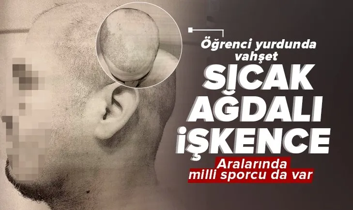 Özel öğrenci yurdunda sıcak ağdalı vahşet! İşkenceciler arasında milli sporcu da var