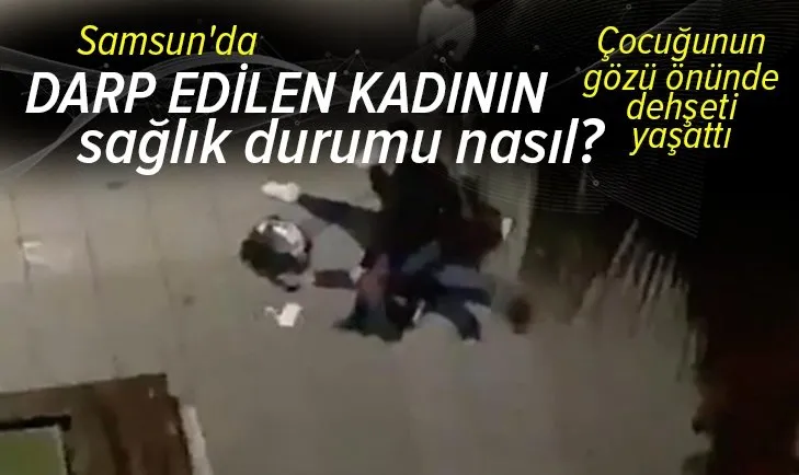 Son dakika: Çocuğunun gözü önünde dövdü! Samsun’da darp edilen kadının durumu nasıl?