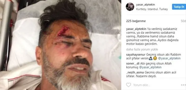 Yaşar Alptekin kaza geçirdi! Kanlar içinde... - 1