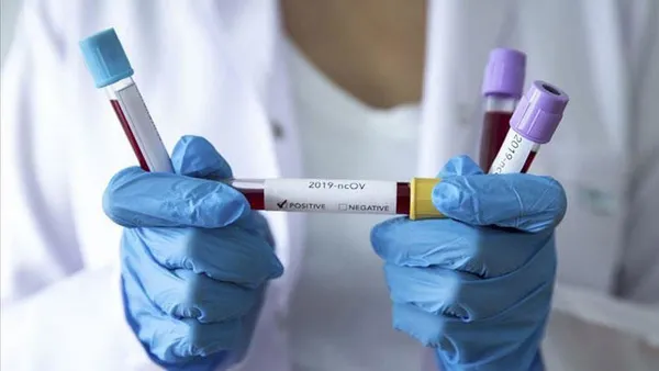 Son dakika:Dünya genelinde koronadan en çok can kaybının yaşandığı 20 ülke!