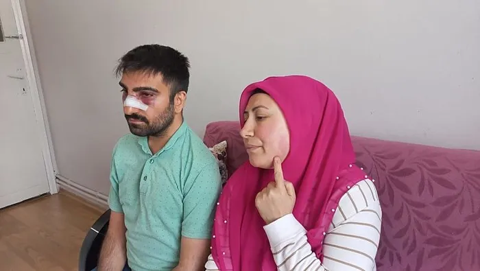 engelli-komsusunun-burnunu-kirdi-ardindan-sicak-su-doktu-1713725095111.jpeg Amasya'da akılalmaz olay! Engelli komşusunun burnunu kırdı: Yetmedi ardından sıcak su döktü - 2