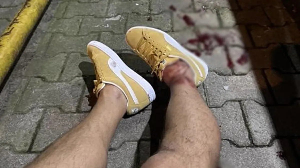 Serhat Akın'a saldırıda ifadeler ortaya çıktı! Saldırganlar birbirine düştü