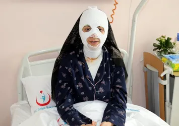 Patlayan düdüklü tencere hastanelik etti