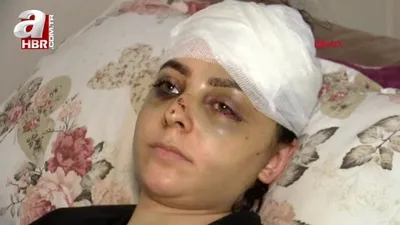 Neden tayt giydin dayağı hastanelik etti!